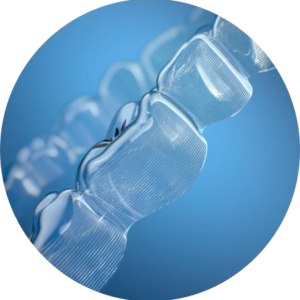 Invisalign-orthodontie