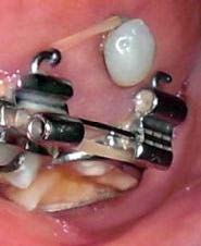 L'essor de l'Orthodontie avec les Mini-Vis d'Ancrage - CISCO - Formation en  orthodontie en France, formation orthodontie à Paris, formation  d'orthodontiste